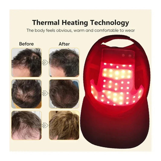 Red Light Therapy for Hair Growth: What You Need to Know